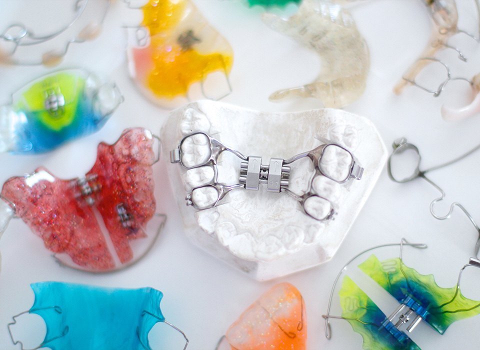 Orthodontic Appliances in Toronto