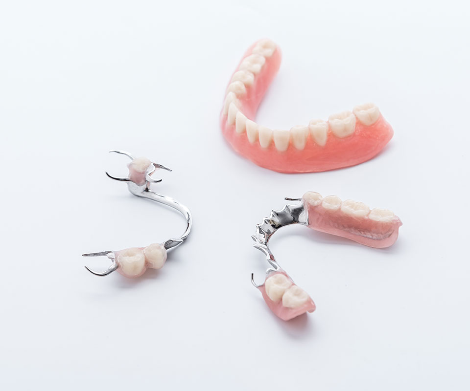 Partial Dentures in Toronto