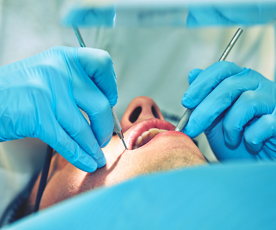 Root Canal Retreatment Toronto