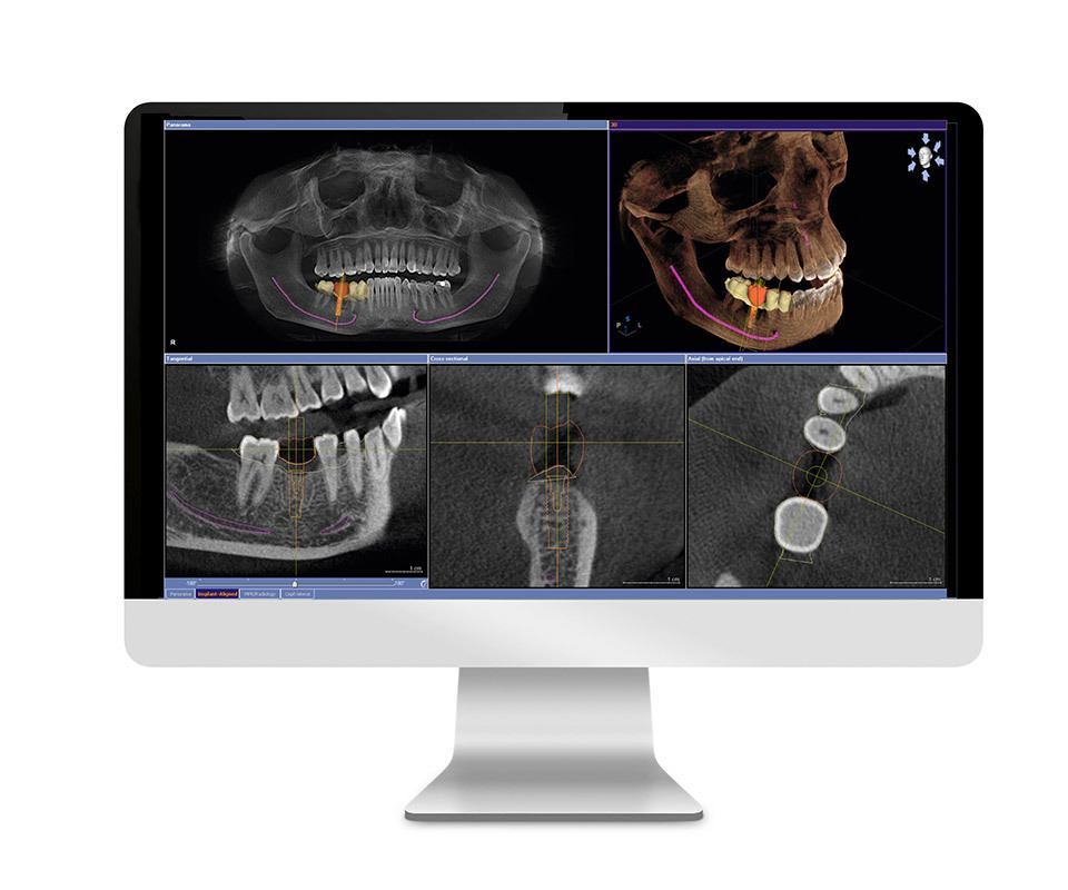 Cone Beam CT 2