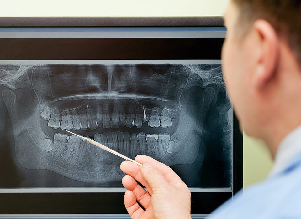Digital Extra Oral X-rays 1