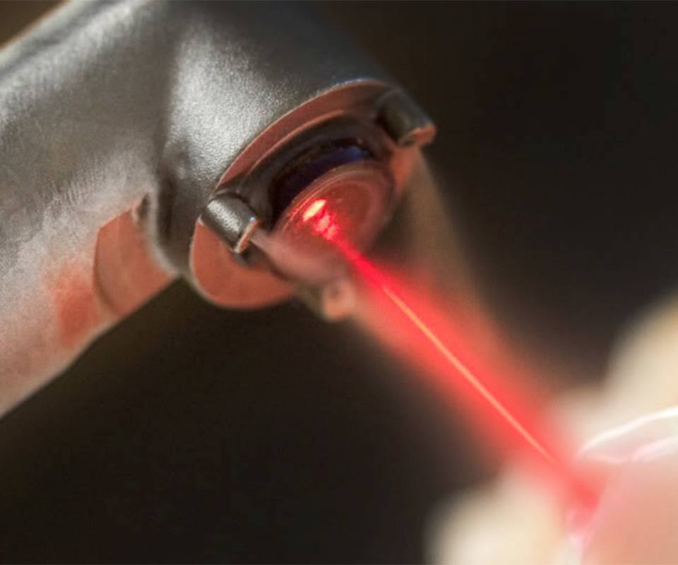 Laser Technology 2