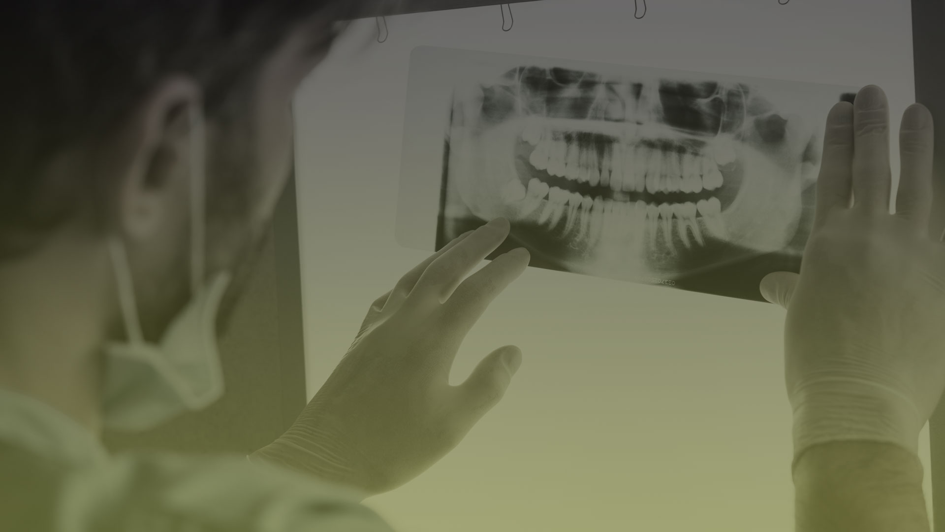 Digital Intra Oral X-Rays