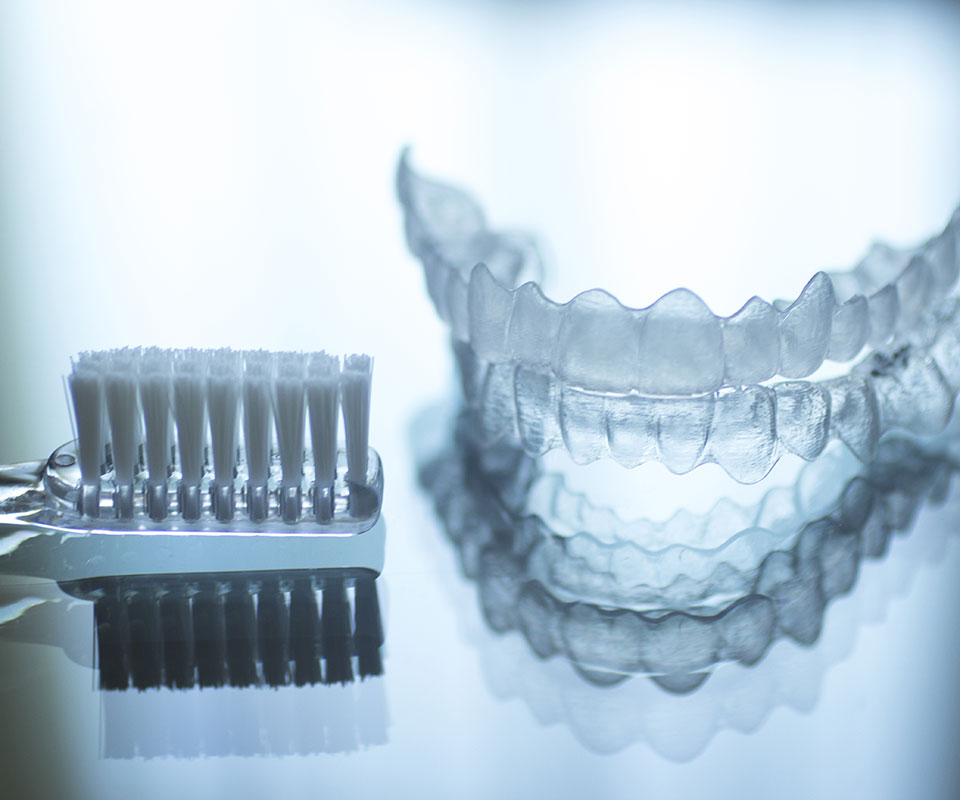 Invisalign cost in King West, Toronto
