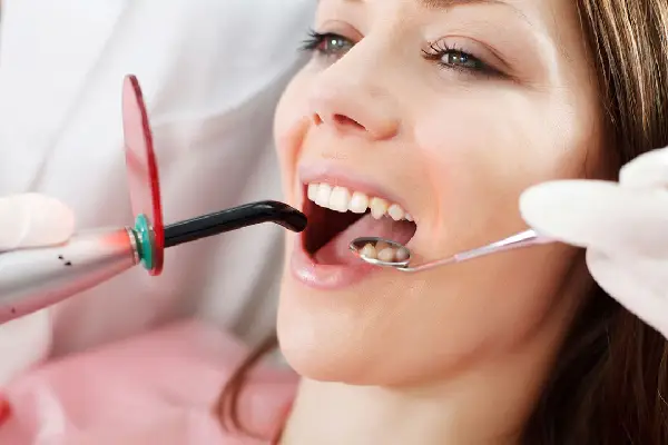 Dental Bridges