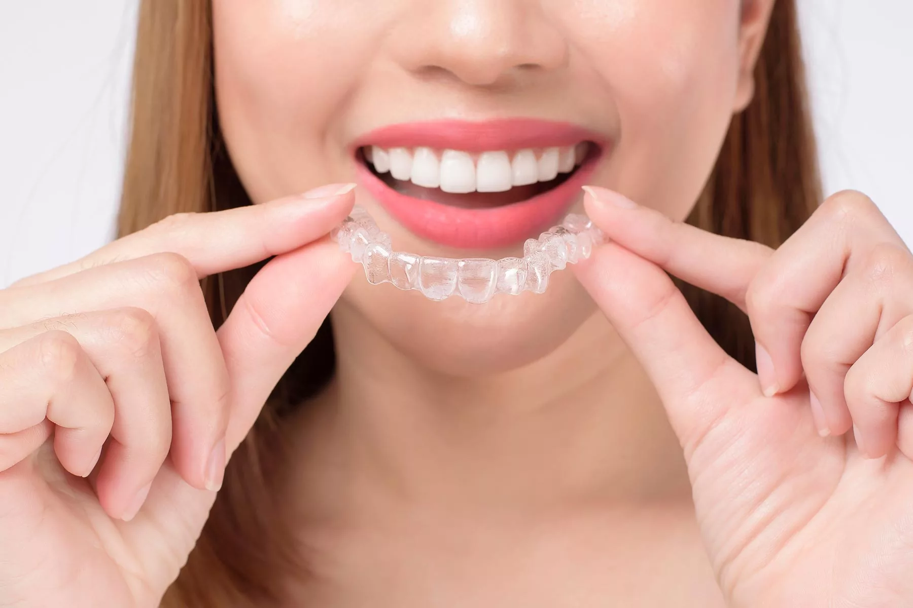 Clear aligner close up