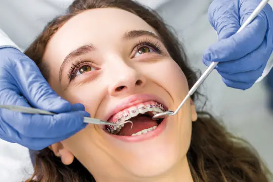 Dental Braces kingwest