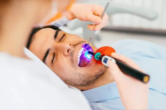 Dental Sealants kingwest