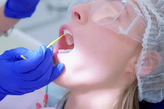 Fluoride Treatment in Downtown Toronto